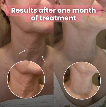 Korean Bio - Collagen Necklift Mask