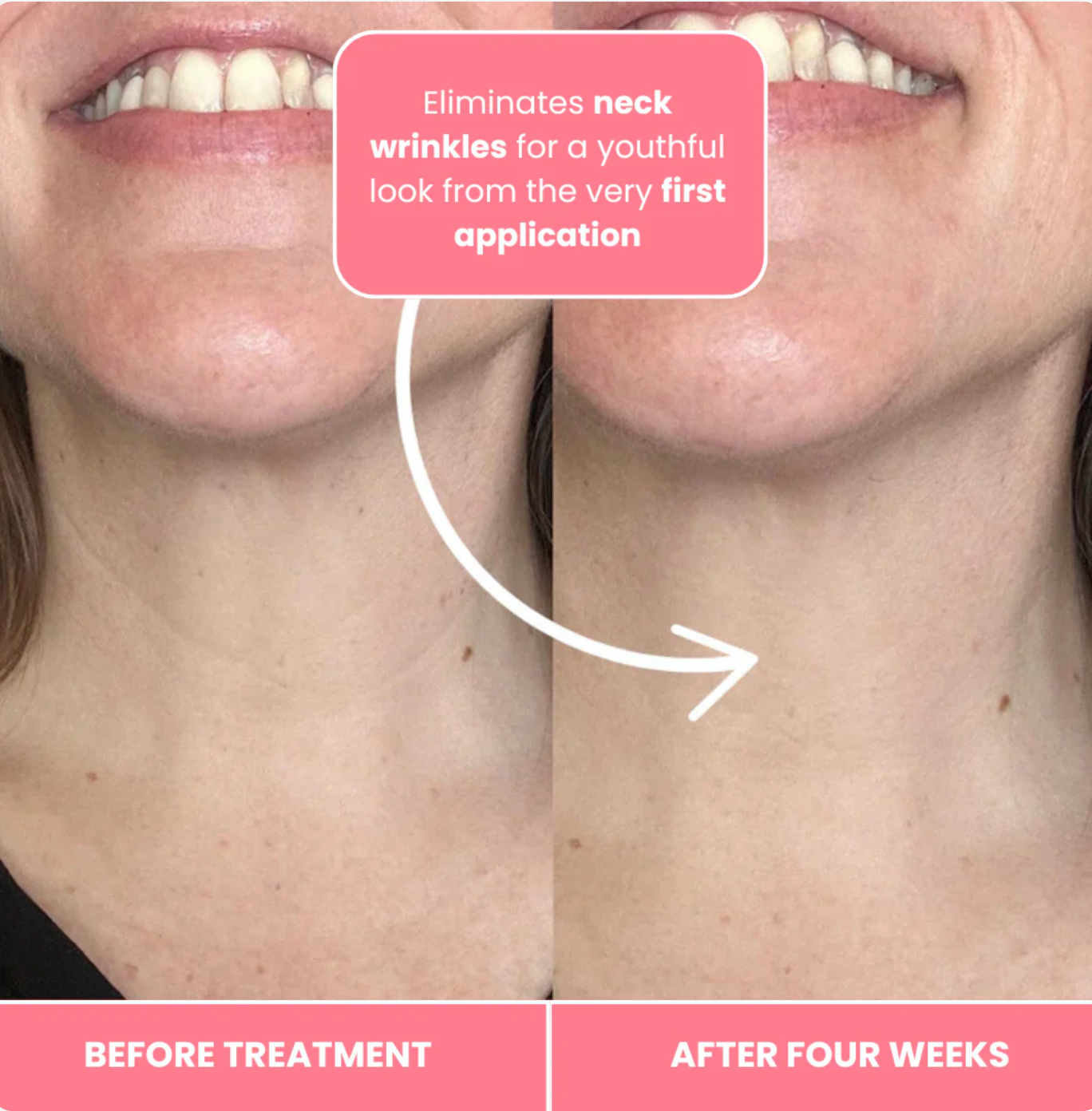 Korean Bio - Collagen Necklift Mask