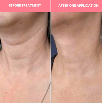 Revitalizing Necklift Bio-Collagen Mask